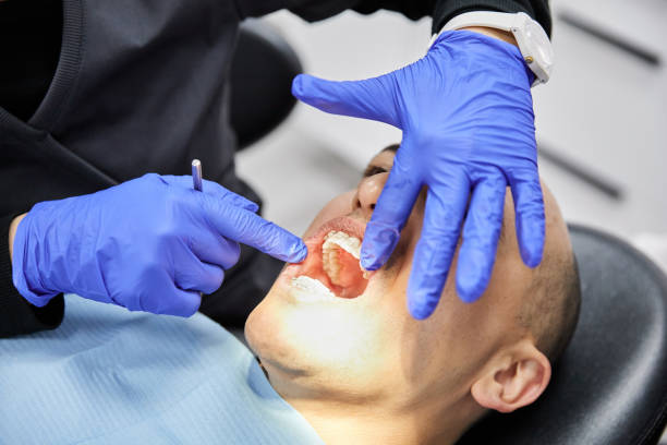 Best Emergency Broken Tooth Repair in Hurley, MS